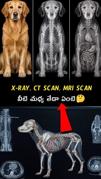 X-RAY, CT SCAN, MRI SCAN వీటి మధ్య తేడా ఏంటి🤔