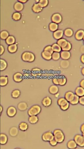 Could lollipops detect cancer?🍭