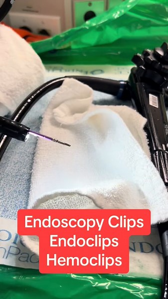 What is an endoscopy clip? #endoscopy #hemoclip #endoclip #colonoscopy #bleedingulcer #gastroenterology