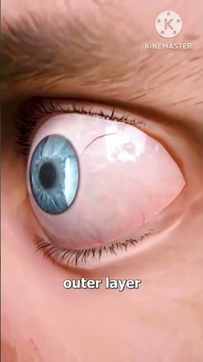 Why Does An EYELASH Get Stuck In Your Eye?