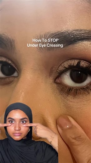 How to Stop Under Eye Creasing | Products and Tips