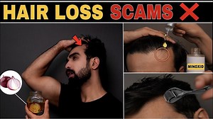 Worst Hair Loss SCAMS❌ *NATURALLY Regrow* Teenage Hair Loss | Hair fall| Hair thinning| Indian Hair | The Formal Edit
