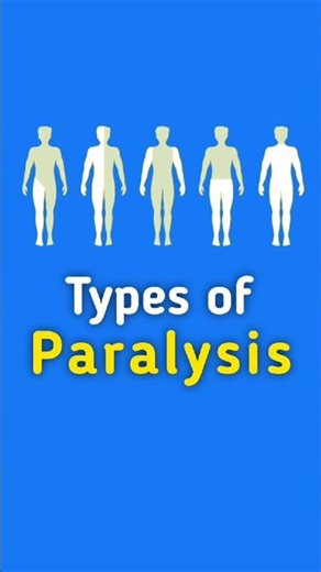 Paralysis Types 🦵🦶 Quick Medical Facts 🩺 #paralysis #medicalshorts #healthshorts