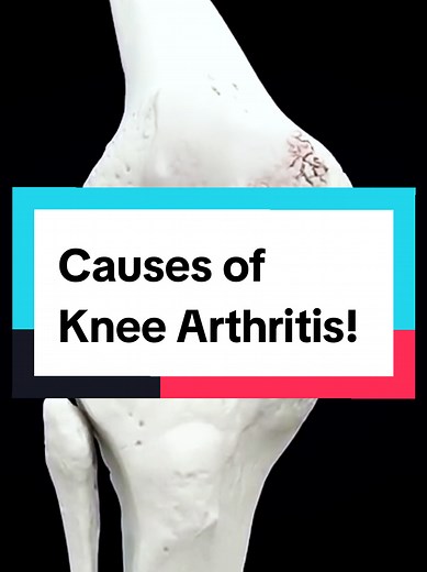 Knee Pain Relief with Shockwave Therapy Solutions