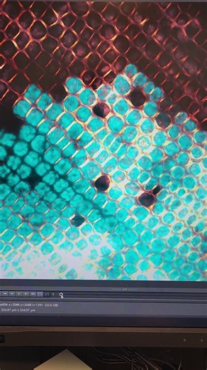 Ecosystem interactions shape spread of wasting disease