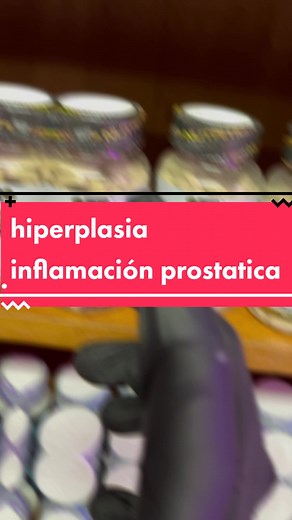 Prostadrol: El Mejor Suplemento para la Hiperplasia Prostática