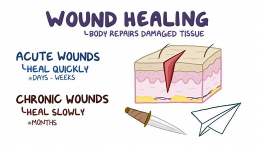 Video: Wound healing - Video Explanation! | Osmosis | Osmosis