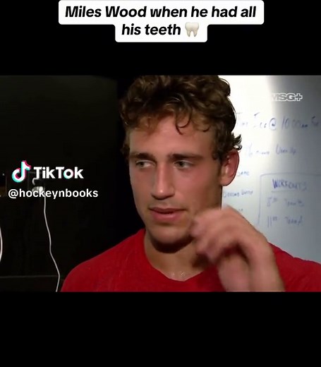 Miles Wood's Unforgettable Toothless Look in Hockey