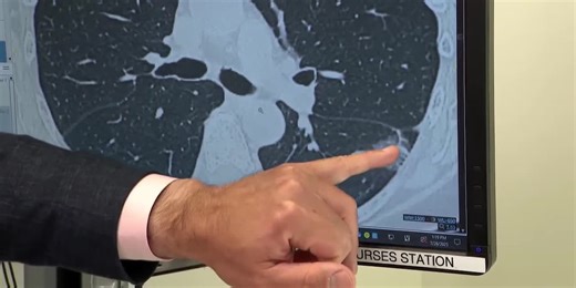 Health Check: What are the treatment options for lung cancer?