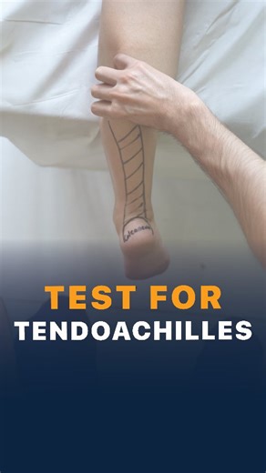 Dr Krunal Soni M.Ch(UK), MS(Gold Medal), FACS(USA), FIASM, F-IOA on Instagram: "A simple home-based test you can do to check for a possible Achilles tendon tear. It is called the Squeeze test. When you gently squeeze your calf, a normal (intact) Achilles Tendon will cause your foot to move. If there is a partial or complete tear, squeezing the calf will not cause any foot movement. Check the integrity of Achilles Injury. Dr. Krunal Soni Knee & Shoulder Specialist | Arthroscopy Surgeon #achillest