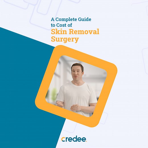 Gain insights into the cost of skin removal surgery and available payment options that can help ease the financial burden. Read the full blog here: https://www.credee.com/a-complete-guide-to-cost-of-skin-removal-surgery/ #Credee #nocreditcheck #FlexiblePaymentplan #SkinRemovalSurgery #SurgeryCosts #FinancialAidForSurgery #HealthcareFinancing #SurgeryPaymentOptions #HealthInvestment #SurgerySavingsTips #SkinSurgerySavings #blog | Credee | Facebook