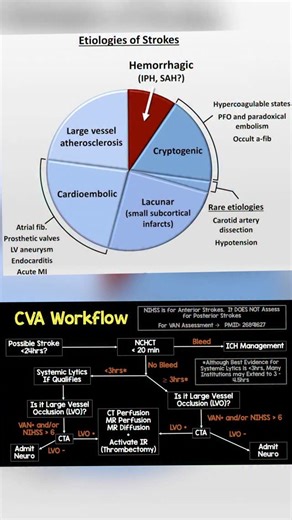 Adeel Ur Rehman on Instagram: "🚨 KNOW THE SIGNS: What Causes a Stroke & Why Every Minute Counts 🚨 A stroke can happen to anyone, at any time. But do you know what’s actually happening inside the brain? Understanding the causes can help you act faster—and save a life. --- 🧠 TWO MAIN TYPES OF STROKE 1️⃣ HEMORRHAGIC STROKE – A burst blood vessel causes bleeding in or around the brain. 2️⃣ ISCHEMIC STROKE – A clot blocks blood flow to the brain. This is more common and includes: · Large vessel at