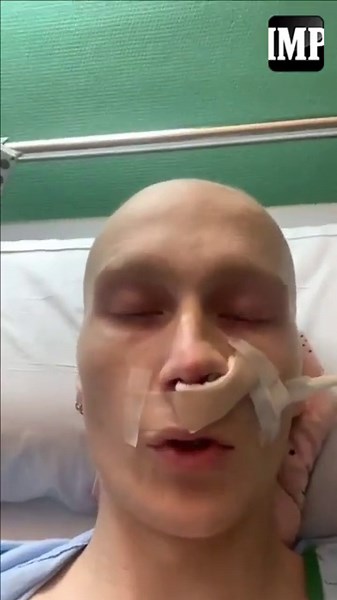 Conoce la historia de Charlie, el tiktoker con cáncer que conquistó los corazones de millones
