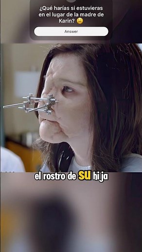 😱🤯 Esta chica parece una bola de chicle | Resúmenes de películas #shorts