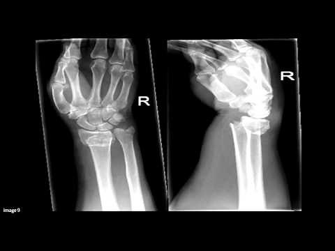 Approach to Orthopaedic X-rays