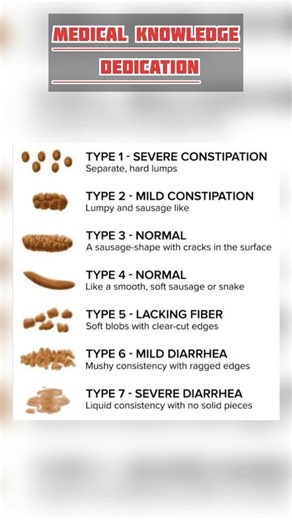 Different types of stool