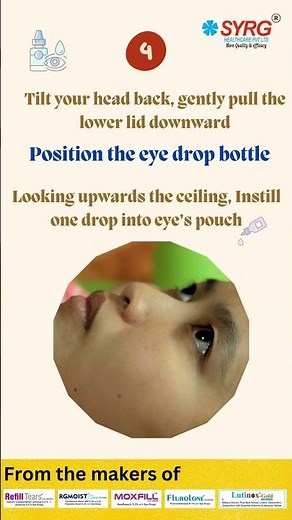 The Right Way to Use Eye Drops: Gentle Tips Inside #eyedrops #healthtips #wellness #selfcare