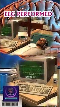 EEG Test Performed : Brain Activity Monitoring Explained