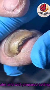 Simple Tips That Help Help Men over 60 Maintain Healthy Toenails #SafeSteps #EverydayCare #WellnessSeniors #DiabeticFootCare | Tots Mags Wheel