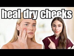 How To Heal Dry Cheeks Overnight