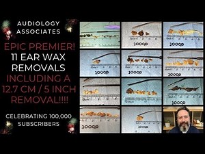 1 HR/11 EAR WAX REMOVALS