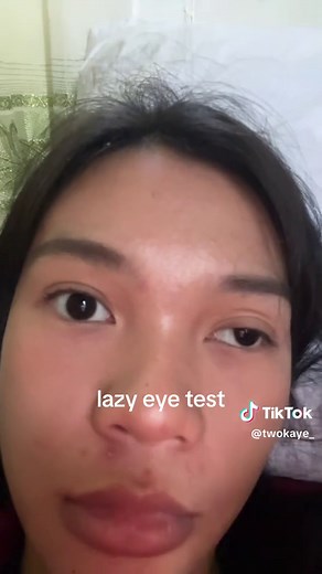 Lazy Eye Test & Simple Fixes: Guide for Slight Lazy Eye