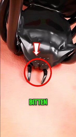 If You Ever Get Bitten by a Spider, Do THIS!😱