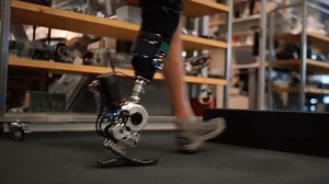 'Miraculous' new bionic leg helps amputees walk 41% than prosthetics