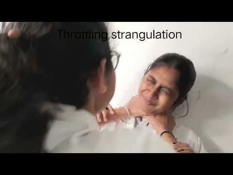 Strangulation of forensic medicine and toxicology 