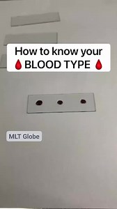 How to do your blood group? 🆎💉🅰️🅱️🅾️🩸⚕️🔬🥼 #bloodgrouping #bloodtyping #medical #labsciences #mlt #mltglobe | Medical Lab Technology - MLT Globe