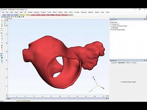 How to Label 3D-Printed Anatomical Models | Materialise Mimics 22