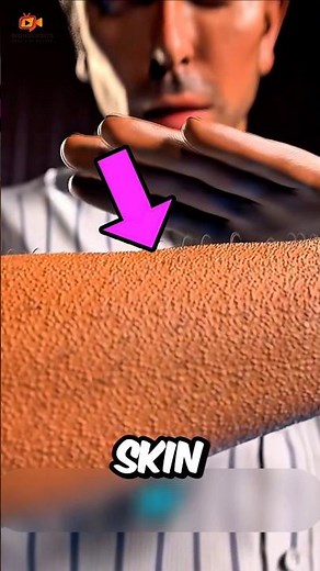 What Really Causes Goosebumps?