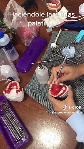 Festoneado de prótesis total: Anatomía y Diseño