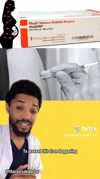 Understanding Rhesus Negative Blood and RhoGAM Injection