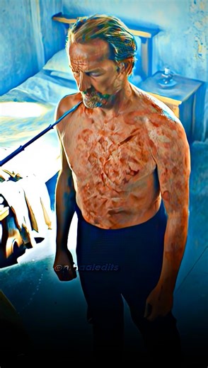 Nihaal Edits | In the HBO series Game of Thrones, Samwell Tarly successfully cures Ser Jorah Mormont of greyscale by performing a dangerous and forbidden... | Instagram