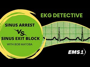 Sinus arrest vs. sinus exit block | EKG Detective