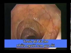 ĐƯỜNG RUỘT VÀ SỨC KHOẺ