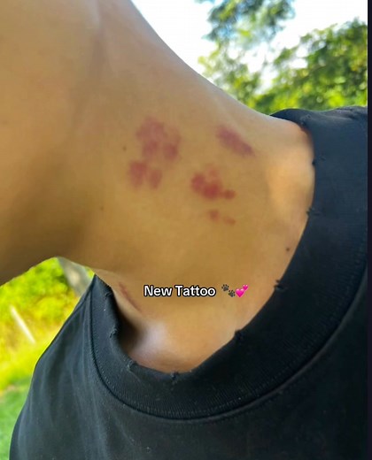 465K views · 8.7K reactions | Oh you get power...✨ | X-ray | Facebook