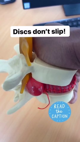 Schoolof Biology | The phrase “slipped disc” refers to a common misconception about spinal disc herniation. People often describe herniated discs as “slipped... | Instagram