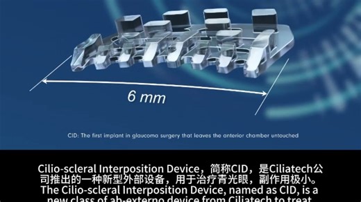 Intercil® 葡萄膜间隔器