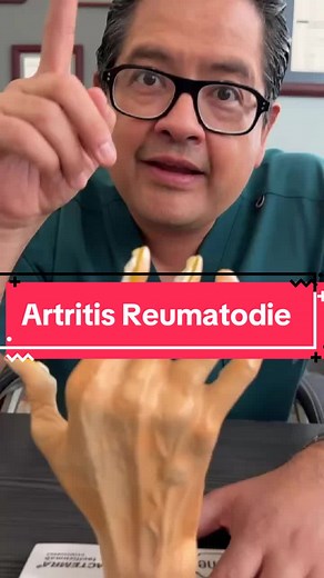 Artritis Reumatoide: Síntomas y Tratamientos por el Dr. Carlos Parra