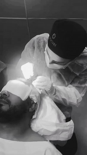 Greffe de cheveux : témoignage et explication détaillée