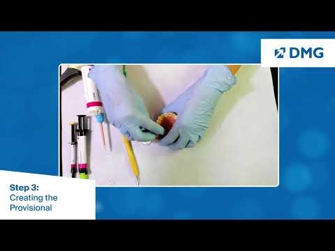 Clinical Provisional Crown and Bridge Workflow: Step 3, Creating the Provisional