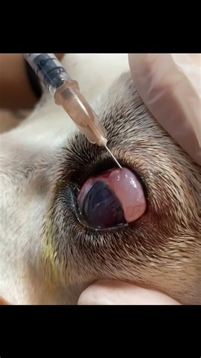 Global Veterinarians 🐾🩺 on Instagram: "➡️ Hyphema-Associated Uveitis in Dogs. • Sub-bulbar conjunctival dexamethasone is used to control severe ocular inflammation in dogs with uveitis secondary to hyphema. Hyphema refers to blood accumulation in the anterior chamber, most commonly caused by blunt ocular trauma. If left untreated, it may lead to increased intraocular pressure and even permanent blindness. Uveitis involves inflammation of the iris, ciliary body, and choroid and is