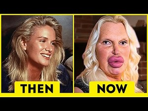 10 Celebrity Plastic Surgery Disasters That Horribly Ruined Their Looks Then and Now 2026