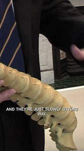 This is one of the most dangerous spinal operations. #LastChanceSurgery | Banijay Documentaries