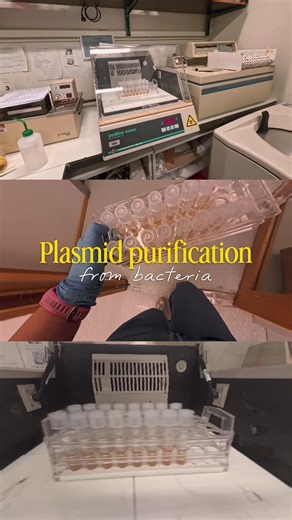 🧬 Plasmid Purification — From Bacteria to DNA 🧪 1. Pelleting the bacteria 🧫 Harvest and spin down the culture to collect the cells. 2. Cell lysis💥 Resuspend the pellet with a buffer containing RNase to remove RNA contamination. Add lysis buffer (SDS NaOH) to disrupt cell membranes and release DNA. 3. Neutralization 🧊 Plasmid DNA re-folds correctly, while genomic DNA and proteins precipitate. Spin to separate debris from plasmid-containing supernatant. 4. Silica column binding 🧲 Under high-