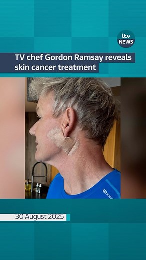 39K views · 1.5K reactions | TV chef Gordon Ramsay reveals skin cancer treatment #itvnews | ITV News | Facebook