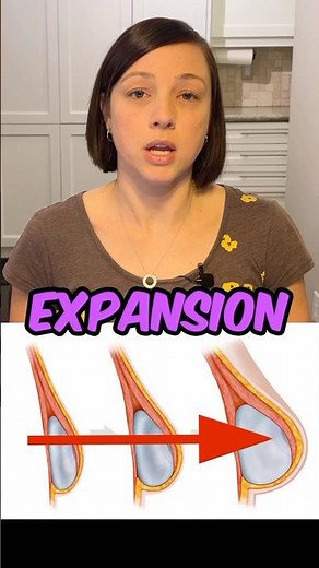 What do Tissue Expanders FEEL Like? #breastreconstruction