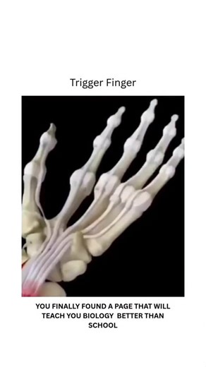 BIOLOGY | MEDICAL | HEALTH on Instagram: "Trigger finger occurs when. A finger gets stuck in a bent position. This happens because the finger’s tendon becomes inflamed and doesn’t slide smoothly in its sheath. When you try to straighten your finger, it may make a snapping noise, like a trigger. This snapping noise is painful and hinders normal finger movement. If nonsurgical treatments don’t work, simple surgery may be the solution. In surgery, a small incision is made in the palm of the hand. T